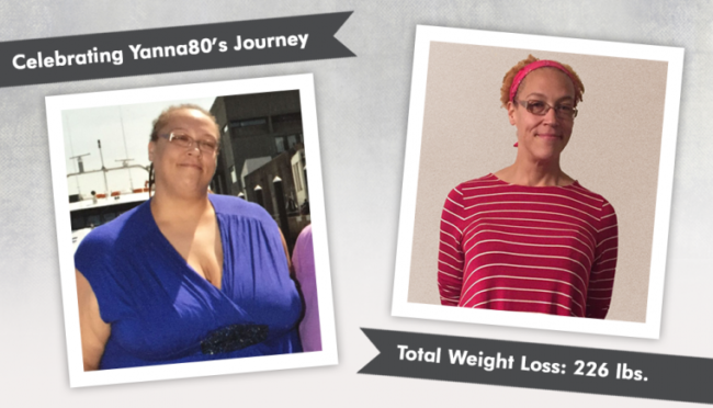 Before-After-VSG-with-Yanna80-The journey-Bariatric Surgery-Health-Travel-Guide-760×435