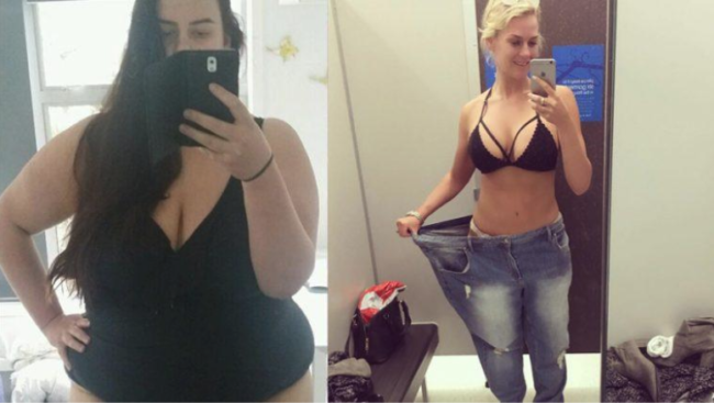 5 people shared their stories about their lives after the Bariatric Surgery