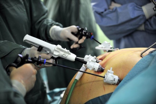 Weight loss surgery – health travel guide