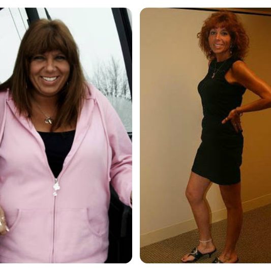 shawnlynn-before-and-after-wls-healthtravelguide