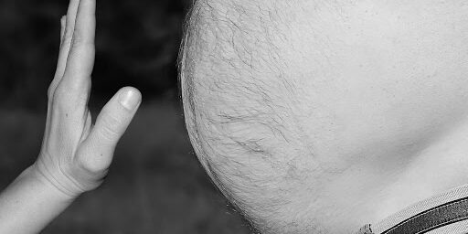 MAIN HEALTH RISK FACTORS OF OBESITY MAIN HEALTH RISK FACTORS OF OBESITY